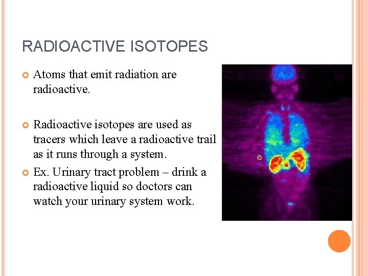 RADIOACTIVE ISOTOPES Atoms that emit radiation are radioactive. Radioactive isotopes are used as tracers