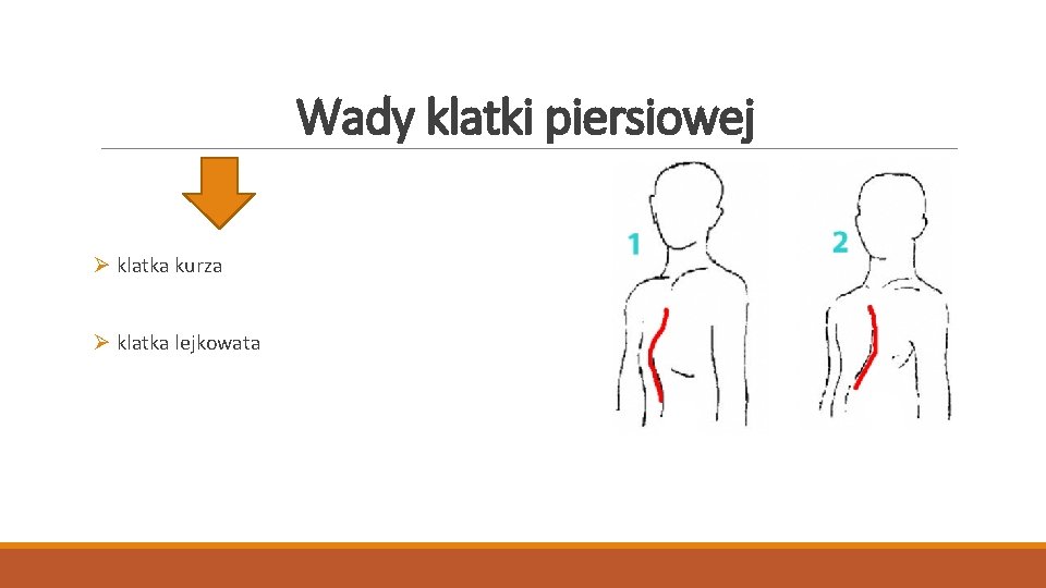 Wady klatki piersiowej Ø klatka kurza Ø klatka lejkowata 