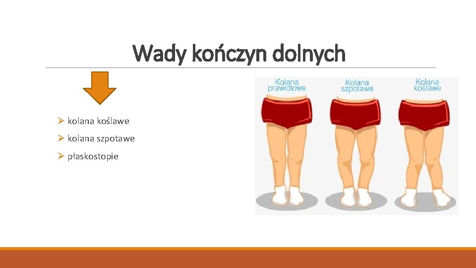 Wady kończyn dolnych Ø kolana koślawe Ø kolana szpotawe Ø płaskostopie 