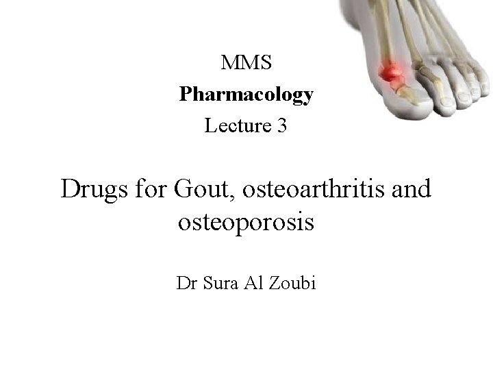 MMS Pharmacology Lecture 3 Drugs for Gout, osteoarthritis and osteoporosis Dr Sura Al Zoubi MMS Pharmacology Lecture 3 Drugs for Gout, osteoarthritis and osteoporosis Dr Sura Al Zoubi