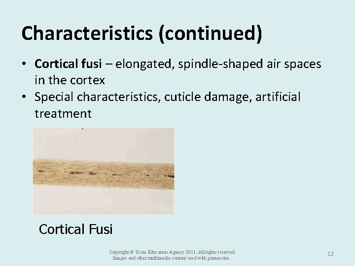 Characteristics (continued) • Cortical fusi – elongated, spindle-shaped air spaces in the cortex •