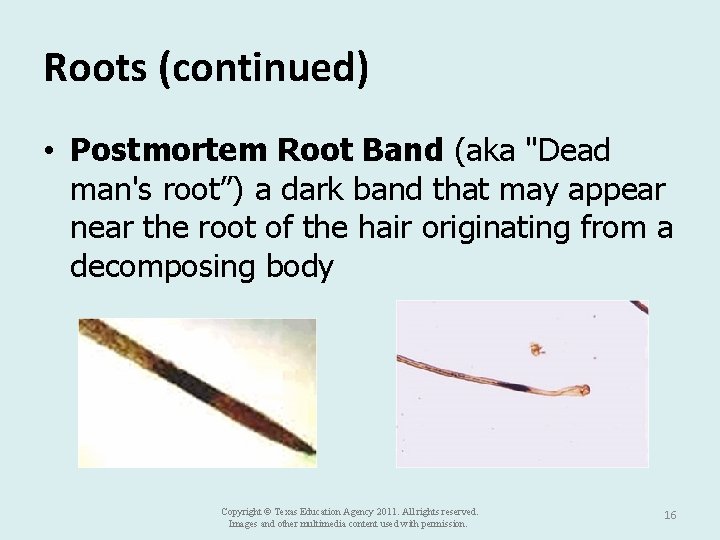 Roots (continued) • Postmortem Root Band (aka "Dead man's root”) a dark band that