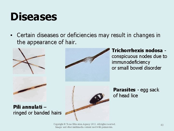 Diseases • Certain diseases or deficiencies may result in changes in the appearance of