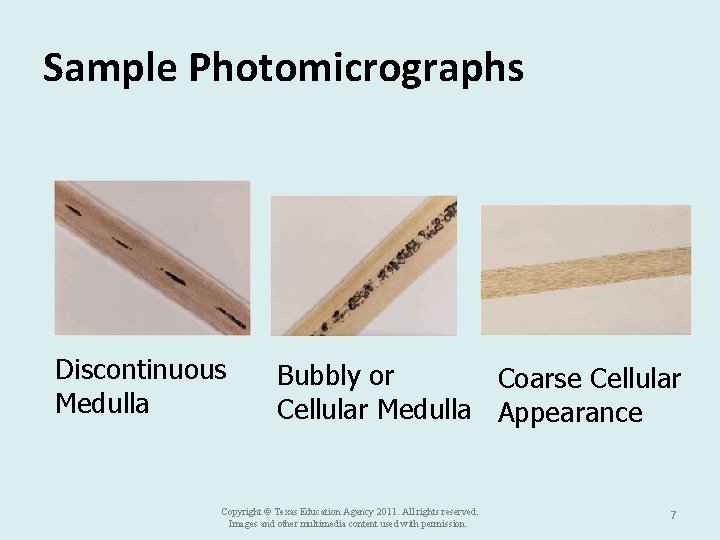 Sample Photomicrographs Discontinuous Medulla Bubbly or Coarse Cellular Medulla Appearance Copyright © Texas Education