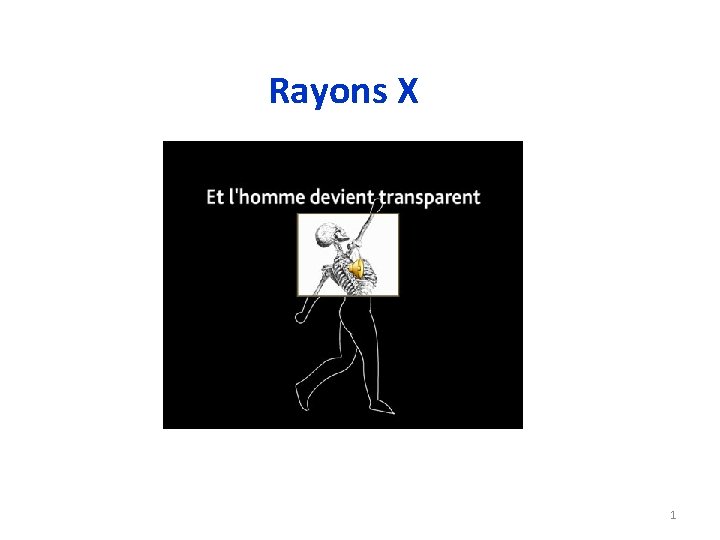 Rayons X 1 