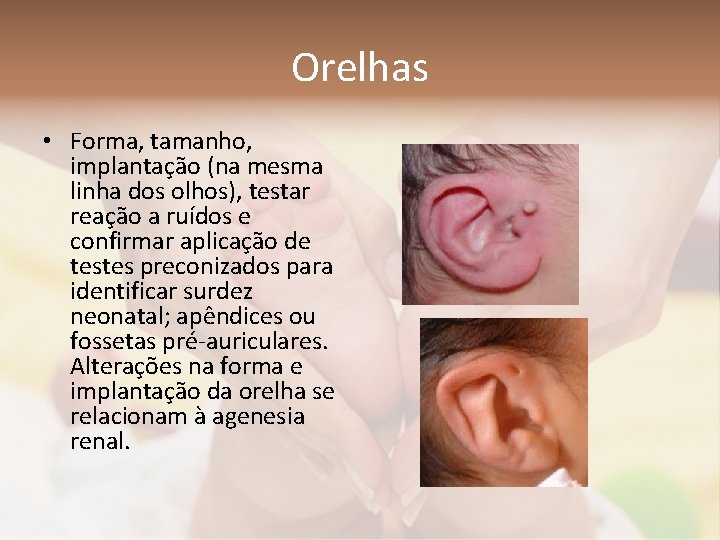 Orelhas • Forma, tamanho, implantação (na mesma linha dos olhos), testar reação a ruídos