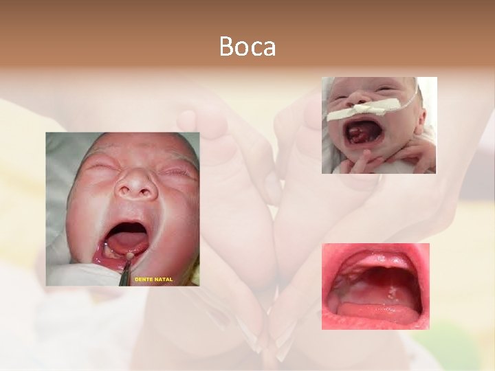 Boca 