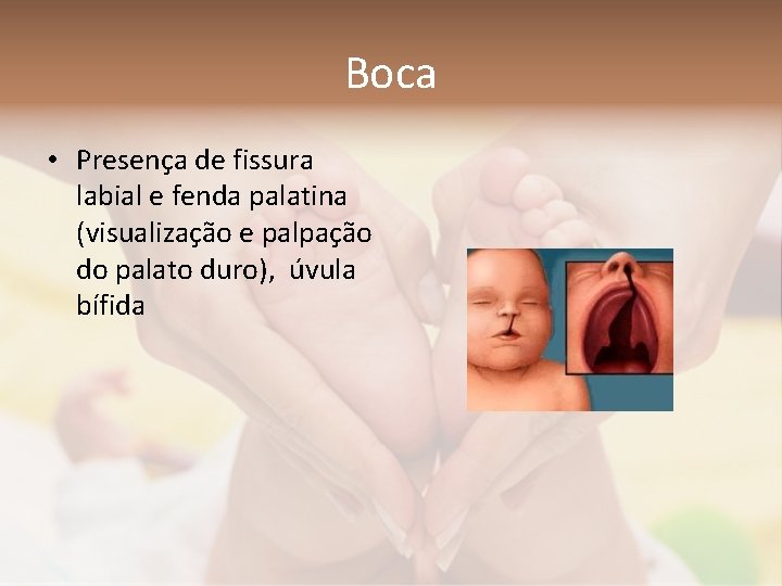 Boca • Presença de fissura labial e fenda palatina (visualização e palpação do palato