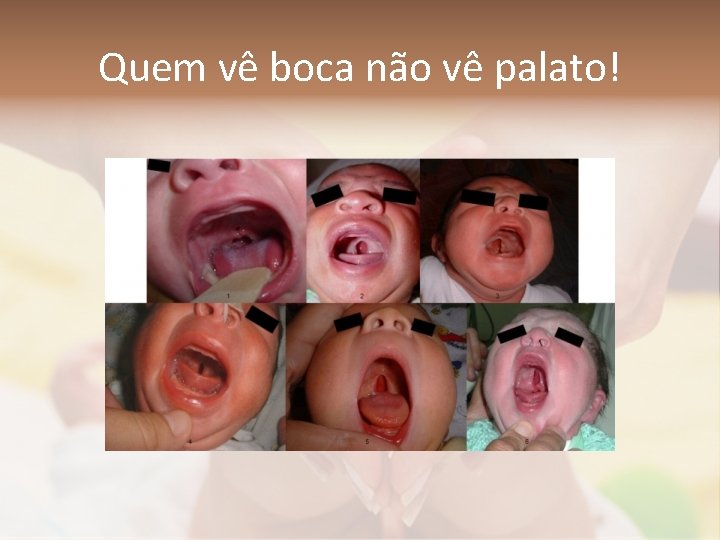 Quem vê boca não vê palato! 