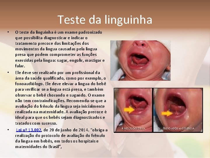 Teste da linguinha • • • O teste da linguinha é um exame padronizado