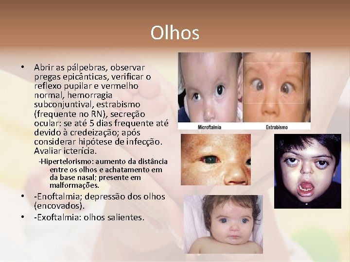 Olhos • Abrir as pálpebras, observar pregas epicânticas, verificar o reflexo pupilar e vermelho