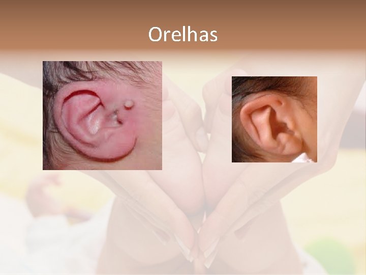 Orelhas 