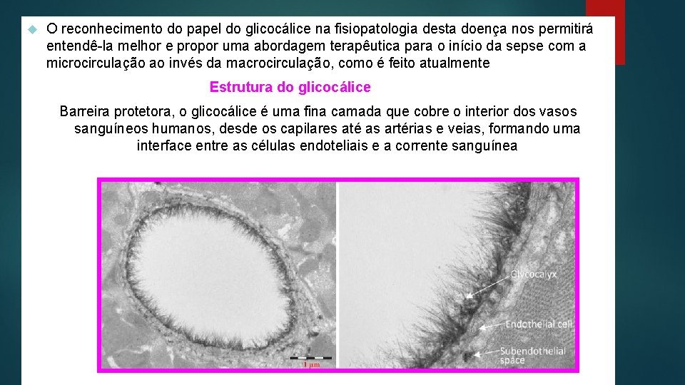  O reconhecimento do papel do glicocálice na fisiopatologia desta doença nos permitirá entendê-la