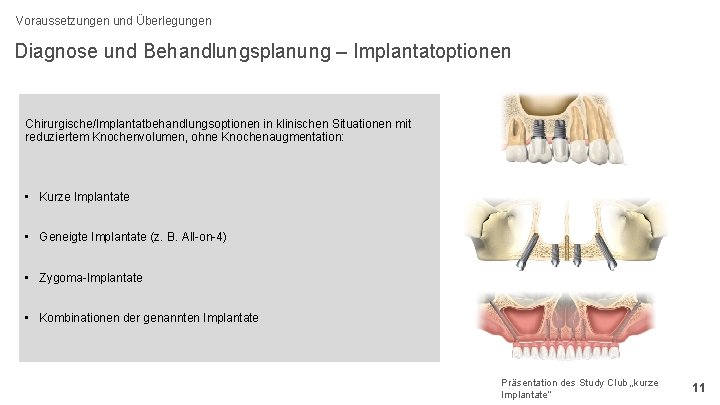 Voraussetzungen und Überlegungen Diagnose und Behandlungsplanung – Implantatoptionen Chirurgische/Implantatbehandlungsoptionen in klinischen Situationen mit reduziertem