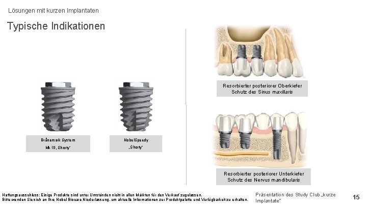 Lösungen mit kurzen Implantaten Typische Indikationen Resorbierter posteriorer Oberkiefer Schutz des Sinus maxillaris Brånemark