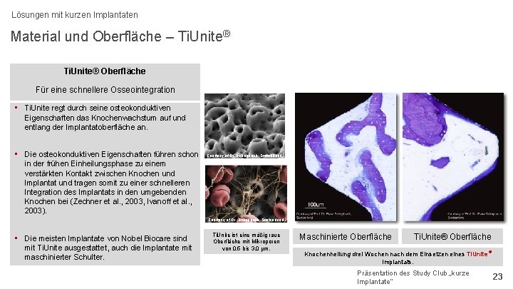 Lösungen mit kurzen Implantaten Material und Oberfläche – Ti. Unite® Oberfläche Für eine schnellere
