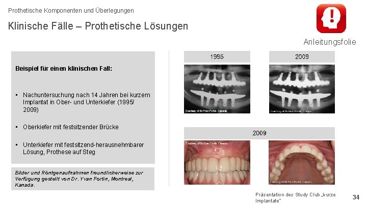 Prothetische Komponenten und Überlegungen Klinische Fälle – Prothetische Lösungen Anleitungsfolie Beispiel für einen klinischen