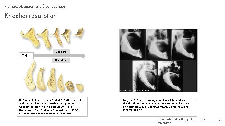 Voraussetzungen und Überlegungen Knochenresorption Oberkiefer Zeit Unterkiefer Referenz: Lekholm U and Zarb GA. Patient