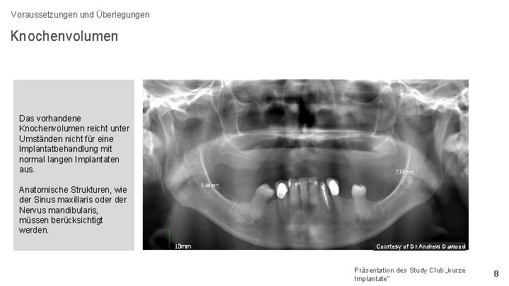 Voraussetzungen und Überlegungen Knochenvolumen Das vorhandene Knochenvolumen reicht unter Umständen nicht für eine Implantatbehandlung