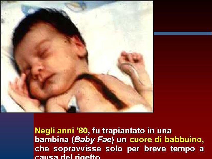 Negli anni '80, fu trapiantato in una bambina (Baby Fae) un cuore di babbuino,