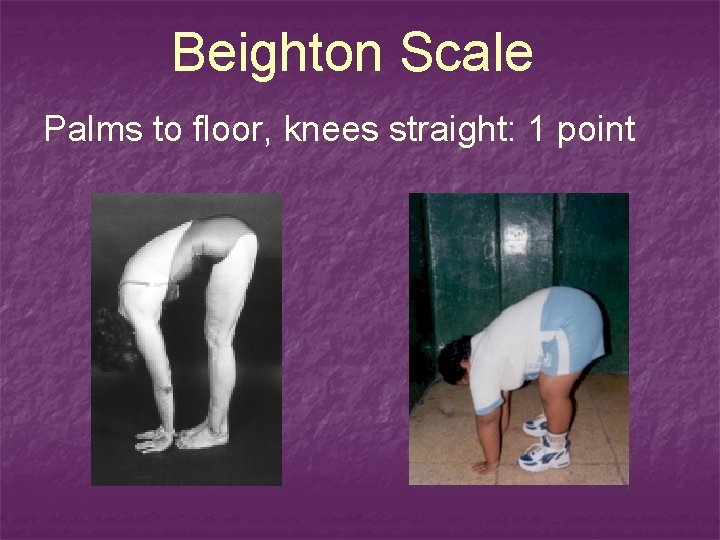 Beighton Scale Palms to floor, knees straight: 1 point 