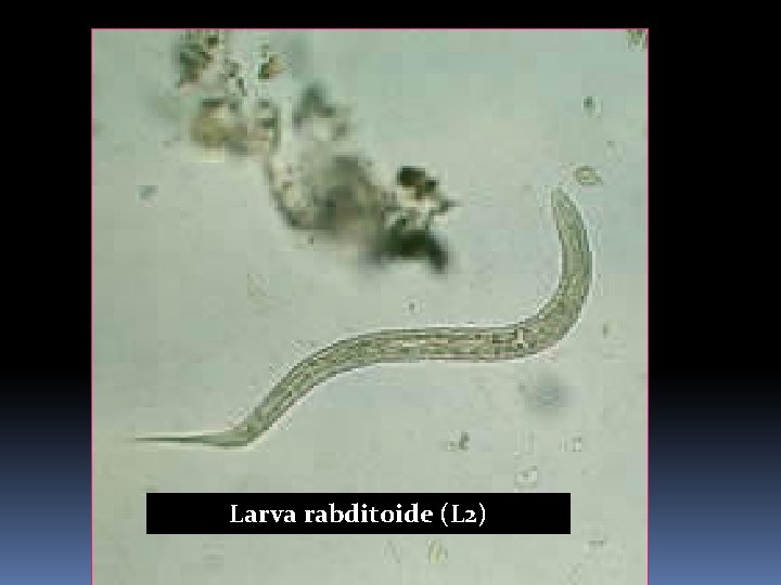 Larva rabditoide (L 2) 