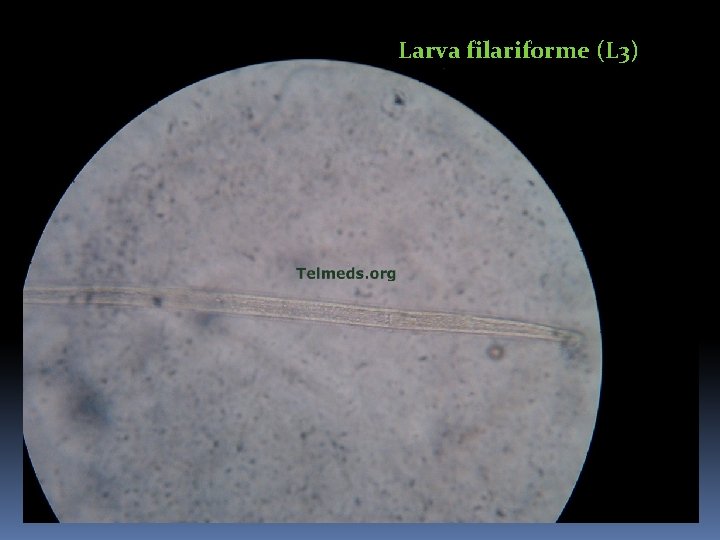 Larva filariforme (L 3) 