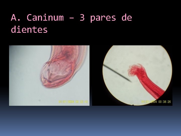 A. Caninum – 3 pares de dientes 