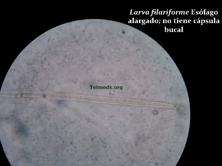 Larva filariforme Esófago alargado; no tiene cápsula bucal 