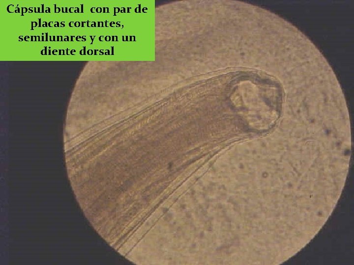 Cápsula bucal con par de placas cortantes, semilunares y con un diente dorsal 