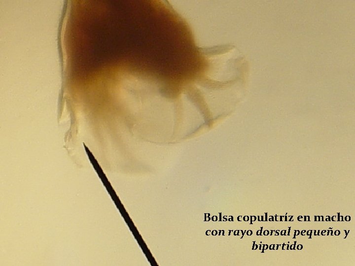 Bolsa copulatríz en macho con rayo dorsal pequeño y bipartido 
