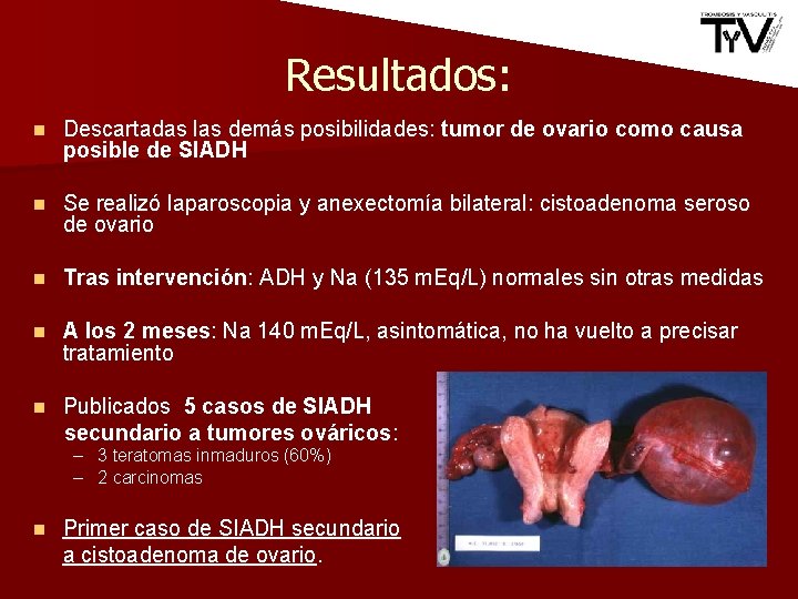 Resultados: n Descartadas las demás posibilidades: tumor de ovario como causa posible de SIADH