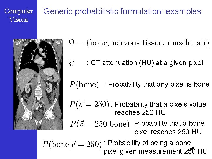 Computer Vision Generic probabilistic formulation: examples : CT attenuation (HU) at a given pixel