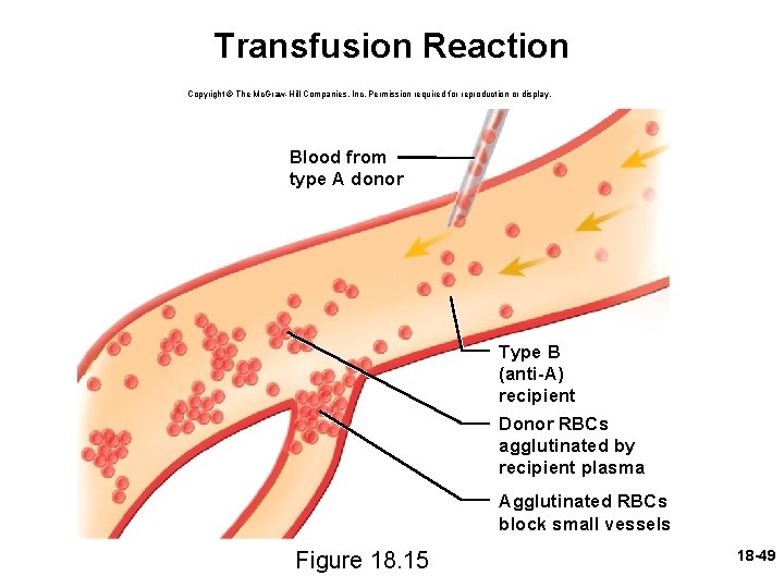 Transfusion Reaction Copyright © The Mc. Graw-Hill Companies, Inc. Permission required for reproduction or