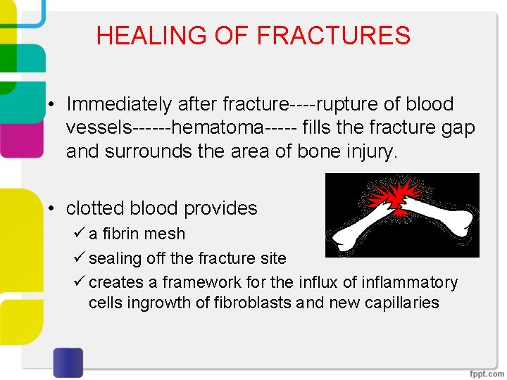 HEALING OF FRACTURES • Immediately after fracture----rupture of blood vessels------hematoma----- fills the fracture gap