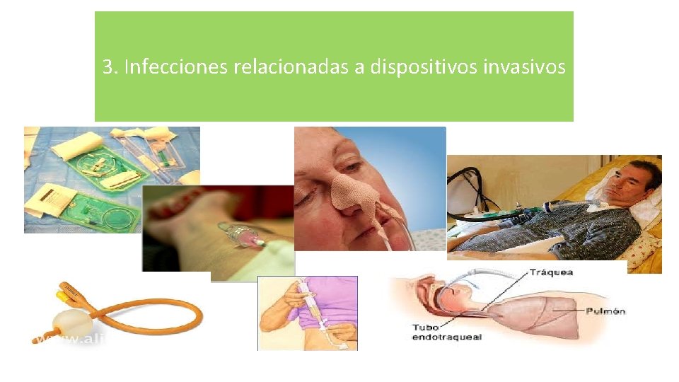 3. Infecciones relacionadas a dispositivos invasivos 