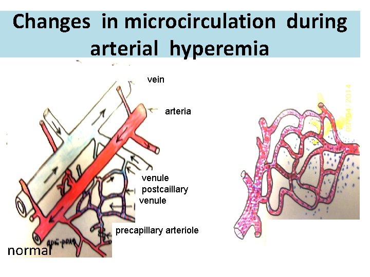 Changes in microcirculation during arterial hyperemia vein arteria venule postcaillary venule precapillary arteriole normal