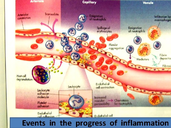 Events in the progress of inflammation 