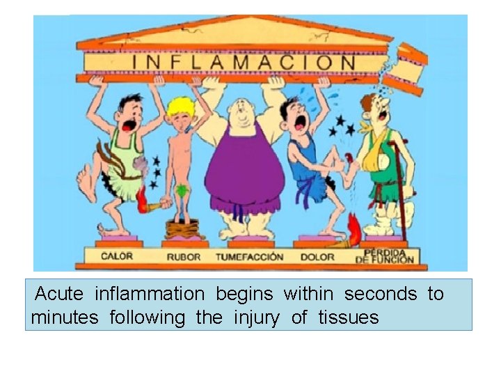 Acute inflammation begins within seconds to minutes following the injury of tissues 