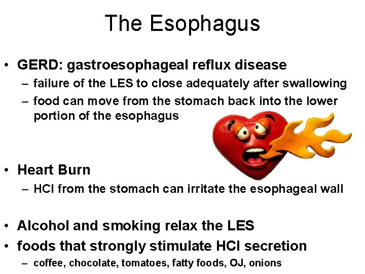 The Esophagus • GERD: gastroesophageal reflux disease – failure of the LES to close