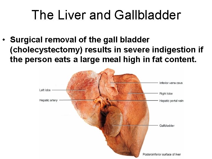 The Liver and Gallbladder • Surgical removal of the gall bladder (cholecystectomy) results in