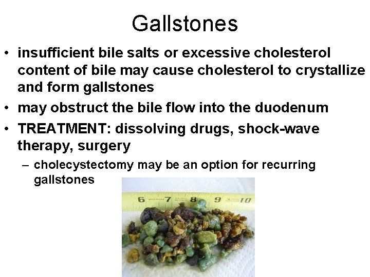 Gallstones • insufficient bile salts or excessive cholesterol content of bile may cause cholesterol