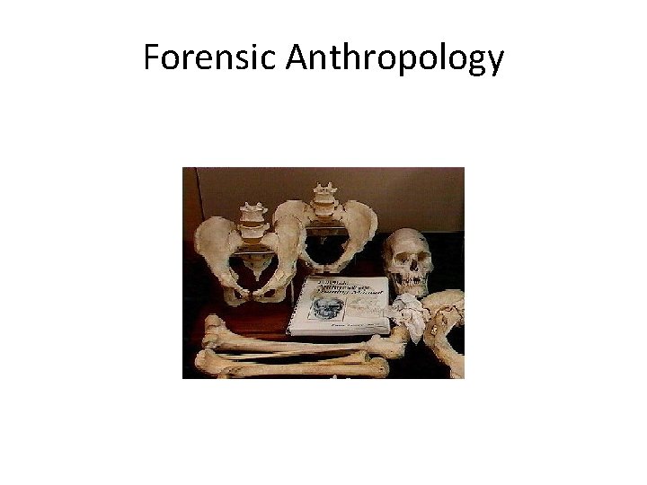 Forensic Anthropology study of human skeletal remains to determine sex, age, race, and time
