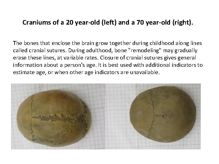 Craniums of a 20 year-old (left) and a 70 year-old (right). The bones that