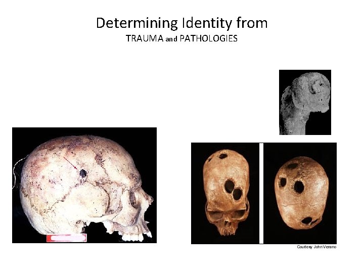 Determining Identity from TRAUMA and PATHOLOGIES 