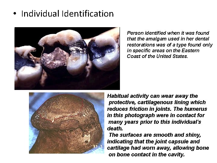  • Individual Identification Person identified when it was found that the amalgam used