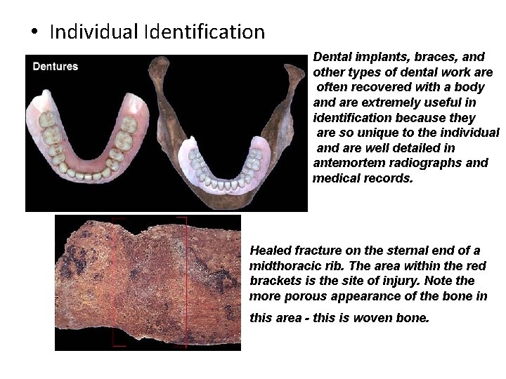  • Individual Identification Dental implants, braces, and other types of dental work are