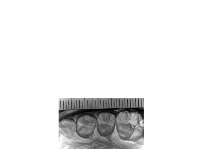 Forensic Odontology • identification of bite marks on victims • comparison of bite marks