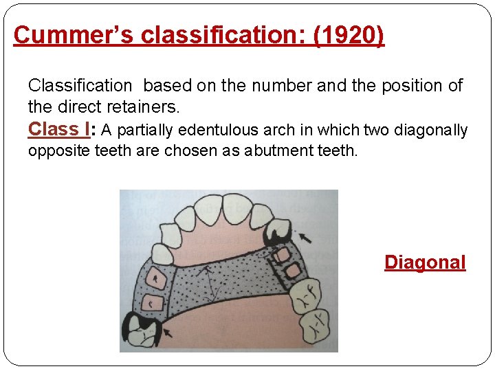 Cummer’s classification: (1920) Classification based on the number and the position of the direct