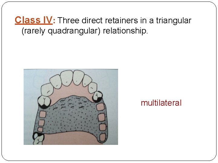 Class IV: Three direct retainers in a triangular (rarely quadrangular) relationship. multilateral 